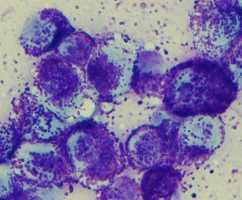 肥満細胞腫の写真