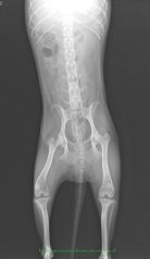 壊死 股関節 大腿骨頭壊死症とは？股関節の痛みに注意！